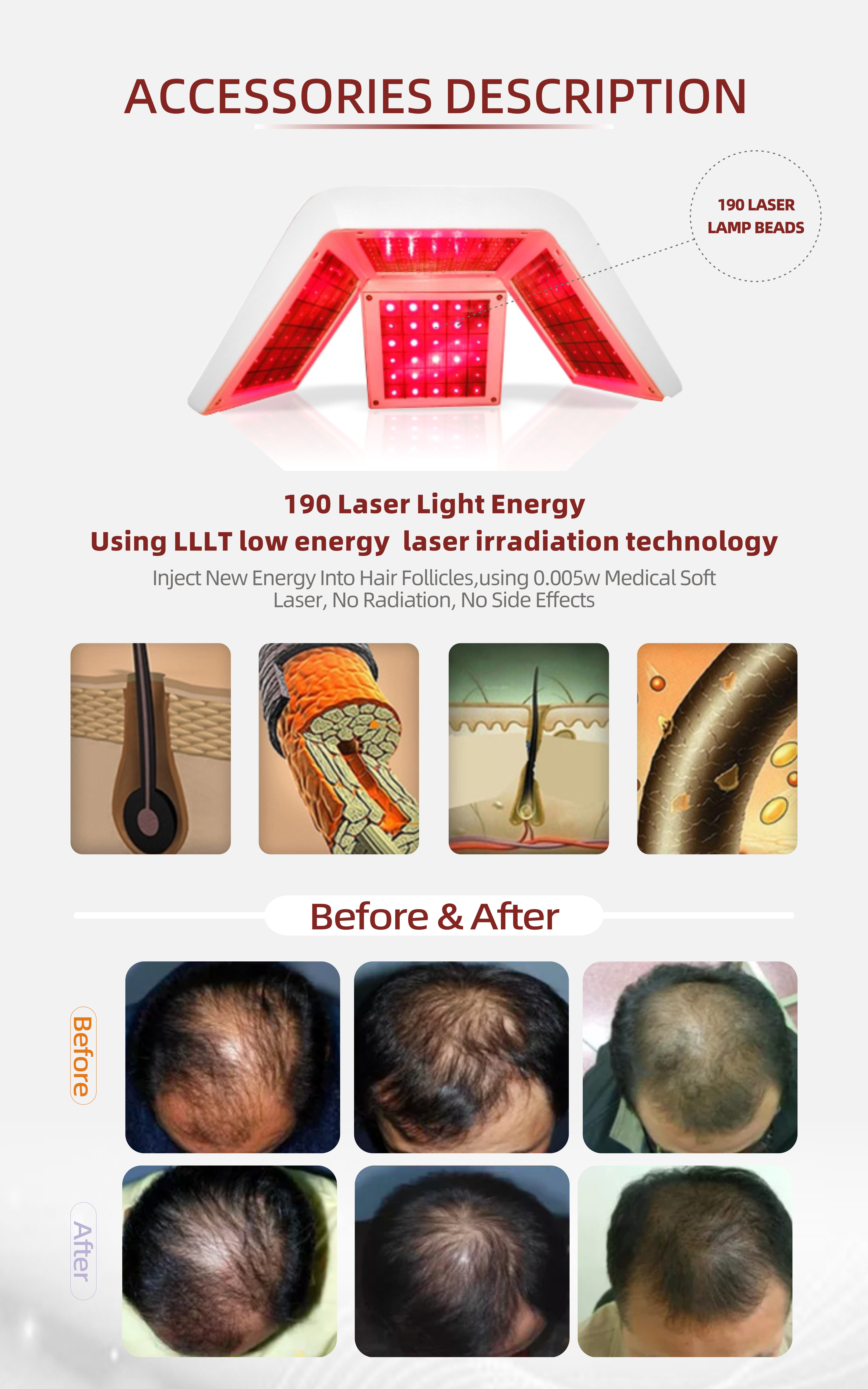 Multifunctional Hair Regrowth 650nm Diode Laser With Skin Analysis Camera Anti Hair Growth Cold Laser Comb Machine For Hair Loss Treatment Multifunctional 650nm Diode Laser Hair Regrowth Machine - Honkay laser hair regrowth machine,laser hair growth machine,hair laser regrowth machine