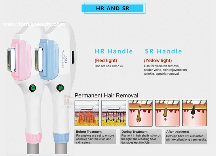 360 magneto optic ipl shr super hair removal machine