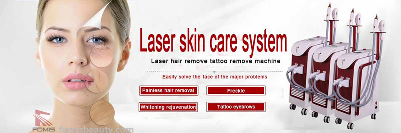 1064 yag laser hair removal