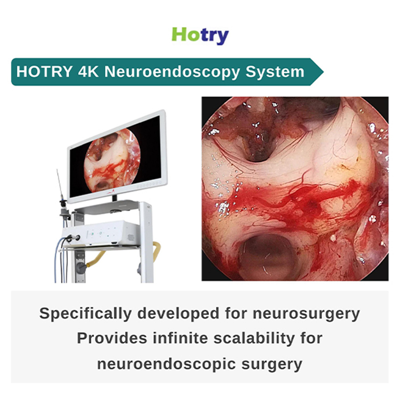 【Hotry 4k Neuroendoscopy System】 In neurosurgery, how should we choose an endoscopic device? Can endoscopic systems in other departments be competent for neurosurgery?