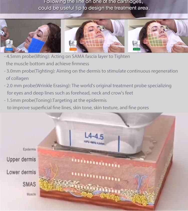 Portable 7D 20000 Times Painless HIFU 7D High Intensity Focused Ultrasound Face Lifting Winkle Removal Skin Rejuvenation Equipment Portable 7d HIFU machine for sale hifu machine,hifu machine price,7d hifu machine