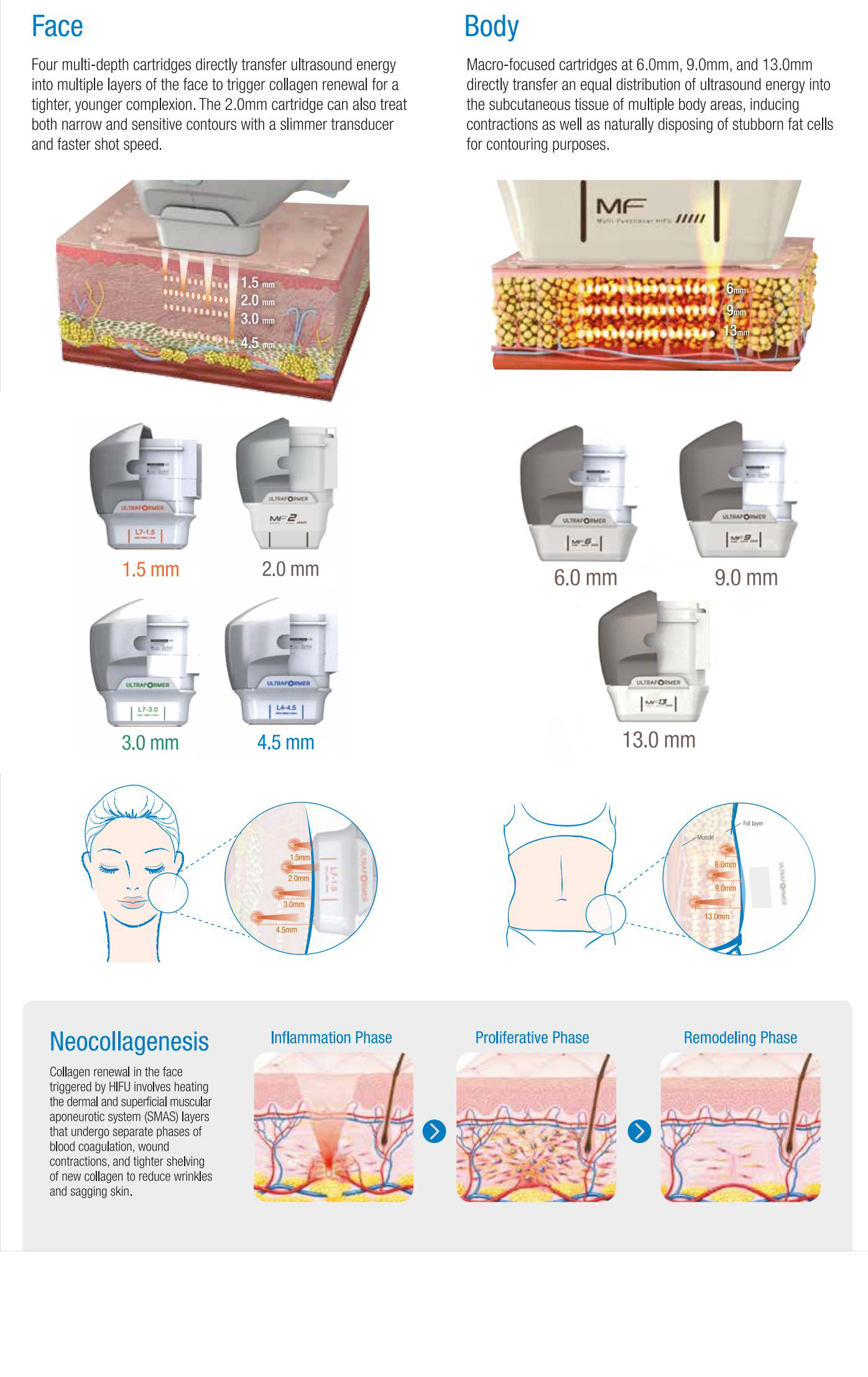 Portable 7D 20000 Times Painless HIFU 7D High Intensity Focused Ultrasound Face Lifting Winkle Removal Skin Rejuvenation Equipment Portable 7d HIFU machine for sale hifu machine,hifu machine price,7d hifu machine
