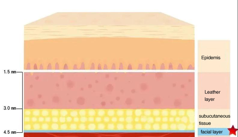 Portable 7D 20000 Times Painless HIFU 7D High Intensity Focused Ultrasound Face Lifting Winkle Removal Skin Rejuvenation Equipment Portable 7d HIFU machine for sale hifu machine,hifu machine price,7d hifu machine