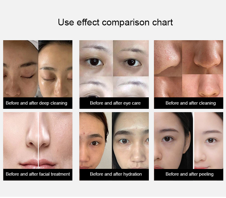 Hydra Oxygen Facial Dermabrasion Machine Ultrasound Eyes Tightening Hydrate Injector Crystal Diamond Microdermabrasion Equipment PDT LED Skin Scrubber Device 14 in 1 Hydra Facial Machine | Honkay hydrafacial machine,14 in 1 hydra facial machine,microdermabrasion machine