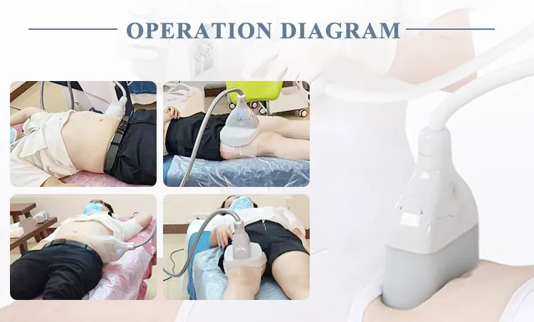 Vertical 5 handles cryotherapy Belly Fat Removal Skin freeze Cryolipolysis Slimming Fat Freezing Machine Cool Tech Sculpting for Double Chin Vertical 5 Handles 360 Cryolipolysis Slimming Machine cryolipolysis machine,fat freezeing machine,cryolipolysis slimming machine