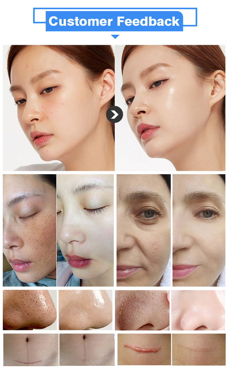 11 In 1 Dermabrasion Facial Machine For Beauty Salon 11 in 1 Hydra Dermabrasion Facial Machine - Honkay hydrafacial machine price,hydra facial machine cost,11 in 1 hydra facial machine