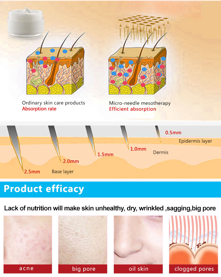 Adjustable Derma Stamp 140 Needles Dermastamp for Skin Rejuvenation Wrinkle Removal Adjustable Derma Stamp 140 Needles Dermastamp for Wrinkle Removal derma stamp,derma stamps,derma stamps 1.5 mm,derma stamps for hair growth,derma stamps adjustable,derma stamps for face,derma stamps 0.5 mm