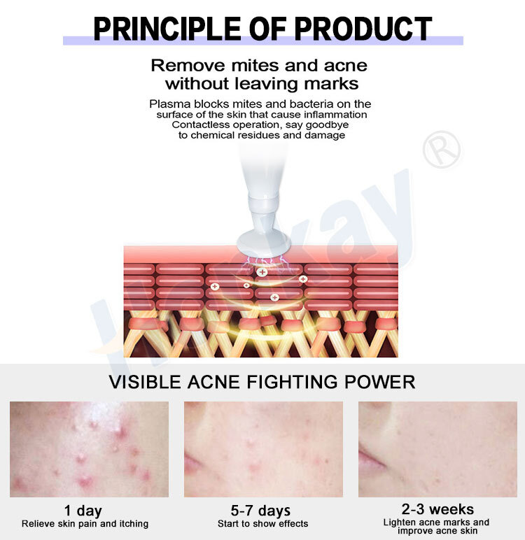 Ozone Plasma Pen Sensitive Skin Anti Wrinkle Deep Acne Cleaner Eliminating Acne Shrink Pores Beauty Purple Light Acne Removal 3 In 1 Ozone Plasma: Clearer, Firmer, Healthier Skin ozone plasma facial,plasma ozone pen,plasma ozone device