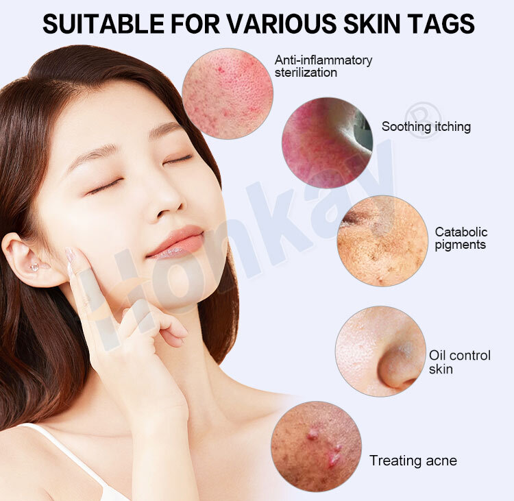 NEW Ozone Plasma Pen Face Cleaner Skin Care Beauty Device Purple Light Sterilization Acne Pimple Remove Plasma Pen Ozone Plasma Pen For Skin: Non-Invasive Anti-Aging Treatment Ozone Plasma Pen,Ozone Plasma Pen for sale,Ozone Plasma Pen cost