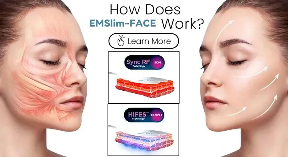 Latest Trending PEface RF Heat Energy Output And Strong Pulsed Magnetic Em Slim Face Vline Face Lift Wrinkle Removal Machine PEface Vline Face Lift Wrinkle Removal Machine | Honkay peface lift machine,ems face lift device,Vline Face Lift Wrinkle Removal Machine