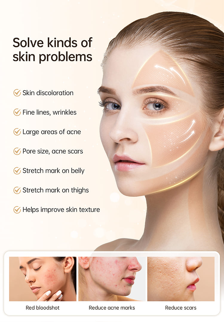 New Developed Hydra pen H5 EMS Microneedling Pen with Containable Needle Auto Serums Applicator MesoTherapy Beauty Device Hydra pen H5 EMS Microneedling Pen with Auto Serums Applicator dr pen hydra pen,hydra pen dr pen,hydra pen