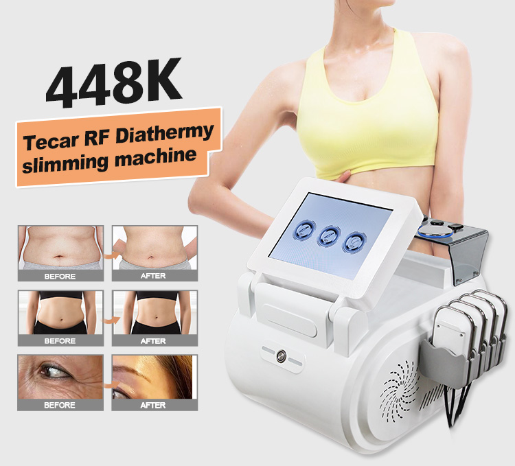 New upgrade 3 in 1 Smart Tecar Therapy 448khz Face Lifting Fat Reduction Body Slimming Machine New Upgrade 3 in 1 448khz Smart Tecar Therapy Machine Supplier Tecar therapy machine,tecar therapy machine for sale,tecar therapy machine cost