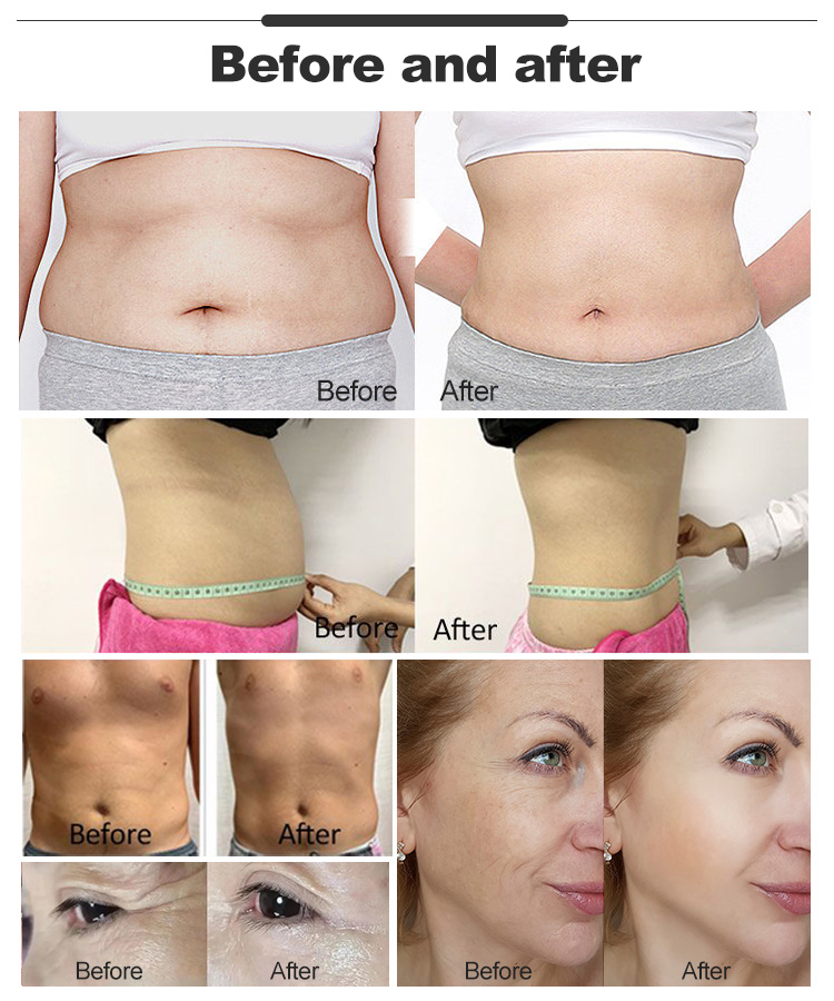 New upgrade 3 in 1 Smart Tecar Therapy 448khz Face Lifting Fat Reduction Body Slimming Machine New Upgrade 3 in 1 448khz Smart Tecar Therapy Machine Supplier Tecar therapy machine,tecar therapy machine for sale,tecar therapy machine cost