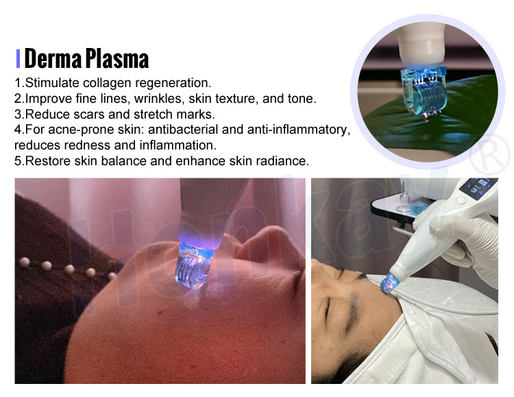 9 In 1 Hot And Cold Plasma Pen Face Lift Acne Treatment Wrinkle Removal Derma Hyper Cold Plasma Machine Portable 9 in 1 Hot and Cold Plasma Machine - Honkay Fusion plasma device,fusion plasma machine,cold plasma machine