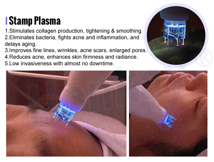 9 In 1 Hot And Cold Plasma Pen Face Lift Acne Treatment Wrinkle Removal Derma Hyper Cold Plasma Machine Portable 9 in 1 Hot and Cold Plasma Machine - Honkay Fusion plasma device,fusion plasma machine,cold plasma machine