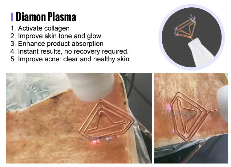 9 In 1 Hot And Cold Plasma Pen Face Lift Acne Treatment Wrinkle Removal Derma Hyper Cold Plasma Machine Portable 9 in 1 Hot and Cold Plasma Machine - Honkay Fusion plasma device,fusion plasma machine,cold plasma machine