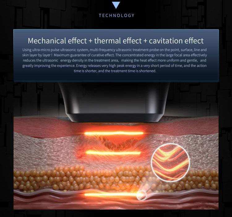 13.3 inch touch screen 12d Hifu shock wave device Skin Tightening Wrinkle Remover Body Slimming Beauty Machine Professional 12d Hifu Machine Price For Anti Aging Care facial Hifu Machine,hifu body device,hifu beauty device