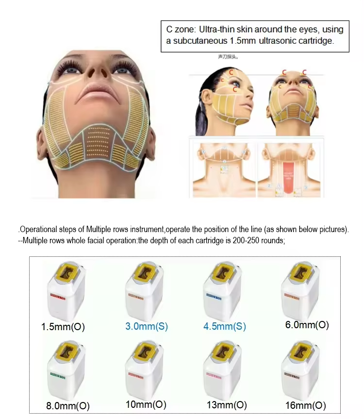 Facial Lifting Skin Firmness Anti-aging Wrinkle Eye Neck Forehead Wrinkles Removal Body Shaping Anti-aging Skin Care Machine Ice 7D Hifu Facial Machine Cost For Wrinkle-Free Skin Care best hifu machine professional,hifu facial machine for sale,Ice 7D Hifu Facial Machine Cost