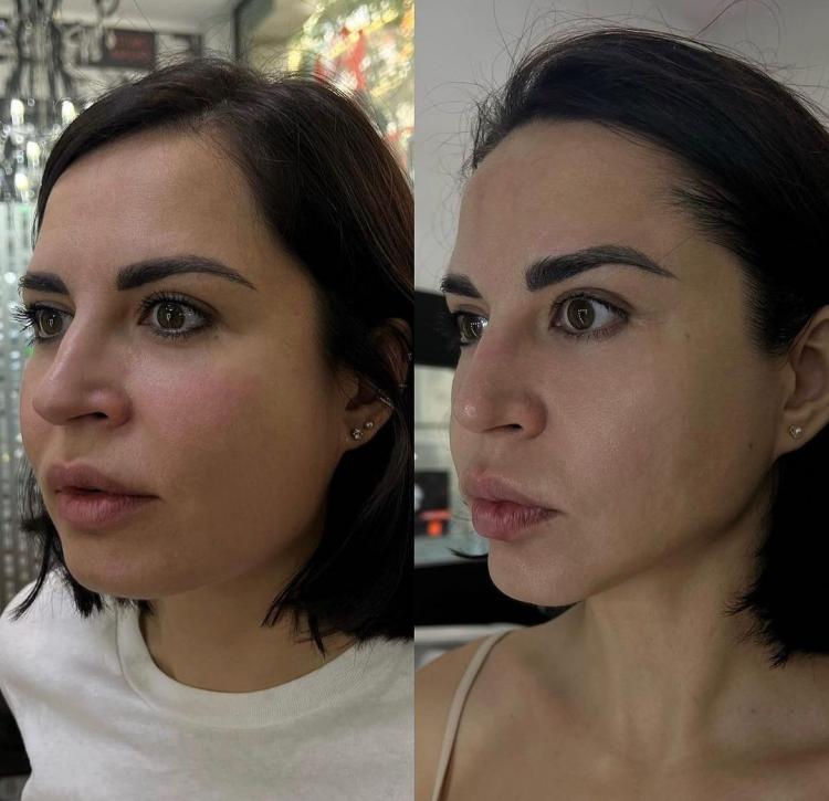 Facial Lifting Skin Firmness Anti-aging Wrinkle Eye Neck Forehead Wrinkles Removal Body Shaping Anti-aging Skin Care Machine Ice 7D Hifu Facial Machine Cost For Wrinkle-Free Skin Care best hifu machine professional,hifu facial machine for sale,Ice 7D Hifu Facial Machine Cost