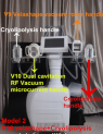 Model 2/V10 velashape+cryolipolysis