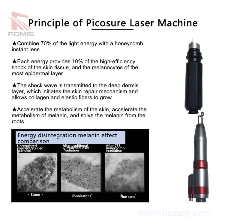 Laser picosure q-switched 1064nm/532nm/755nm tattoo removal Machine
